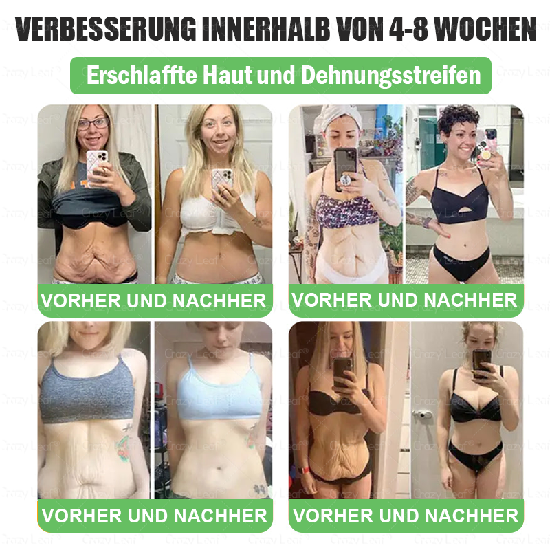 💚💚⏰Herzlichen Glückwunsch! Du hast ein exklusives 𝐂𝒓𝓪𝙯𝙮𝐋A𝑒𝑎𝐟®-Angebot freigeschaltet! Als Dankeschön für deine Bestellung erhältst du heute zusätzlich 30 % Rabatt! Klicke unten, um dir dieses Spezialangebot zu sichern – nur für kurze Zeit gültig!⏰