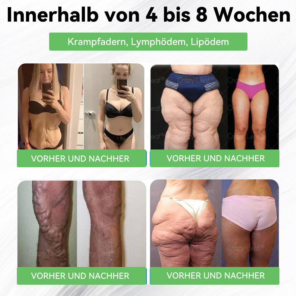 💚💚⏰Herzlichen Glückwunsch! Du hast ein exklusives 𝐂𝒓𝓪𝙯𝙮𝐋A𝑒𝑎𝐟®-Angebot freigeschaltet! Als Dankeschön für deine Bestellung erhältst du heute zusätzlich 30 % Rabatt! Klicke unten, um dir dieses Spezialangebot zu sichern – nur für kurze Zeit gültig!⏰