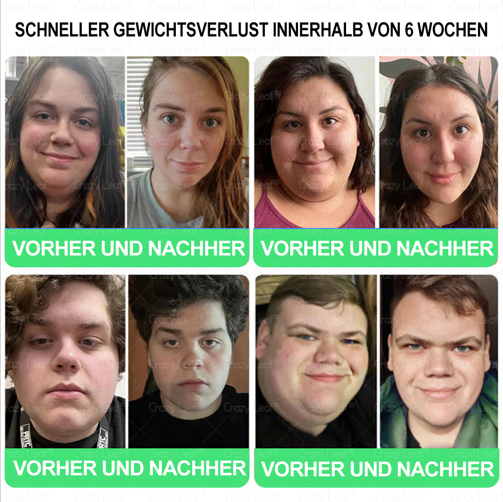 💚💚⏰Herzlichen Glückwunsch! Du hast ein exklusives 𝐂𝒓𝓪𝙯𝙮𝐋A𝑒𝑎𝐟®-Angebot freigeschaltet! Als Dankeschön für deine Bestellung erhältst du heute zusätzlich 30 % Rabatt! Klicke unten, um dir dieses Spezialangebot zu sichern – nur für kurze Zeit gültig!⏰