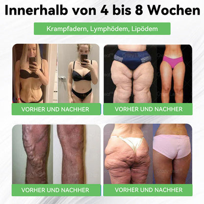 💚💚⏰Herzlichen Glückwunsch! Du hast ein exklusives 𝐂𝒓𝓪𝙯𝙮𝐋A𝑒𝑎𝐟®-Angebot freigeschaltet! Als Dankeschön für deine Bestellung erhältst du heute zusätzlich 30 % Rabatt! Klicke unten, um dir dieses Spezialangebot zu sichern – nur für kurze Zeit gültig!⏰