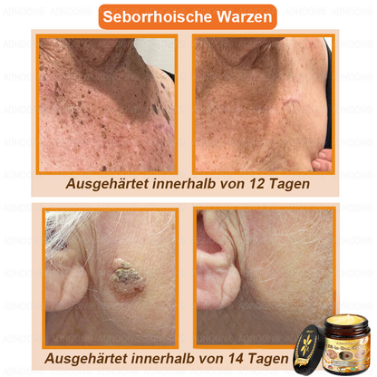 ADNOON®🌐Bienengift All-in-One Pflegecreme—👨🏻‍⚕️Empfohlen von der DDG 🥇🥇